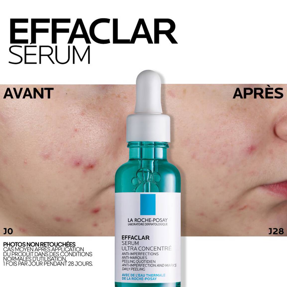 La Roche-Posay EFFACLAR Sérum à l'Acide Salicylique Ultra Concentré